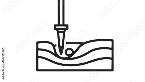 A medical illustration of a syringe injecting into layered tissue