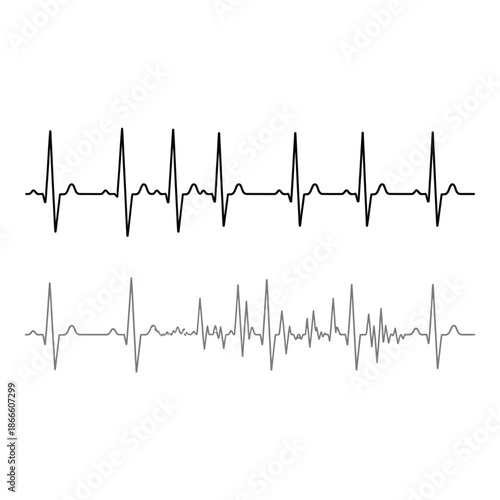 Visual representation of two distinct electrocardiogram readings illustrating heart activity