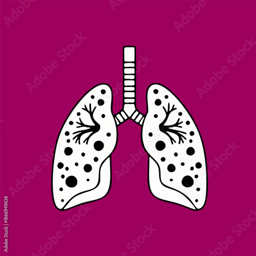 Illustrative depiction of human lungs showing signs of respiratory illness or pulmonary disease, a medical concept