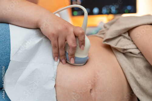 Pregnant woman getting an abdominal ultrasound scan detecting fetal heartbeat and monitoring prenatal health