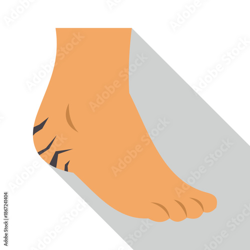 Human foot illustrating common cracked dry skin condition on the heel area