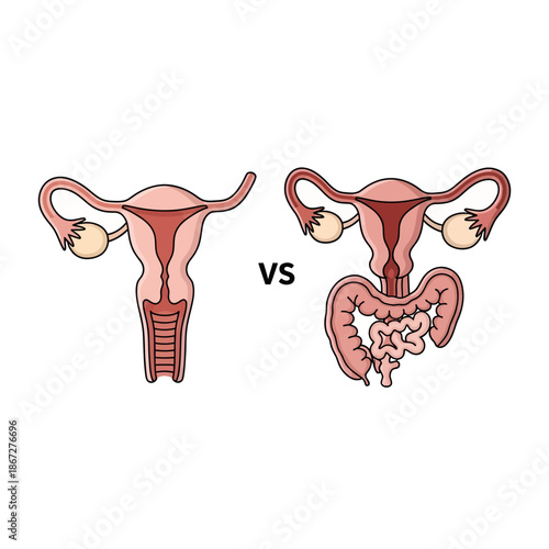 Female Reproductive System vs. Abdominal Organs Illustration