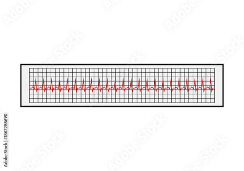 Gráfico de electrocardiograma con ritmo cardíaco constante sobre papel cuadriculado médico