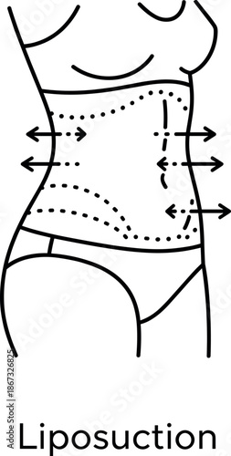 Liposuction cosmetic surgery icon showing body contouring procedure on female torso