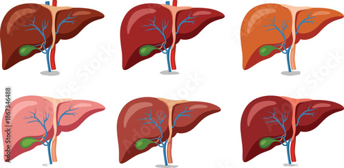 human liver anatomy illustration set healthy diseased liver stages medical infographic organ healthcare biology vector isolated white background