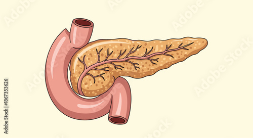 Anatomical illustration of the human pancreas and duodenum highlights the organ structure and bile ducts on a soft yellow background.