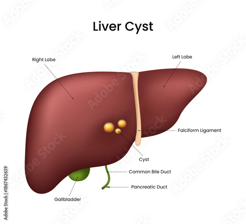 Human Liver Anatomy with Cysts and Associated Structures