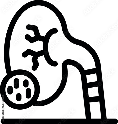 Medical procedure involving catheter insertion into kidney for removing stones, treating urolithiasis and improving urinary system health