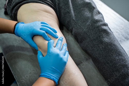 Close up of Physiotherapist working with patient on the bed stock photo