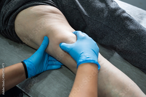 Close up of Physiotherapist working with patient on the bed stock photo