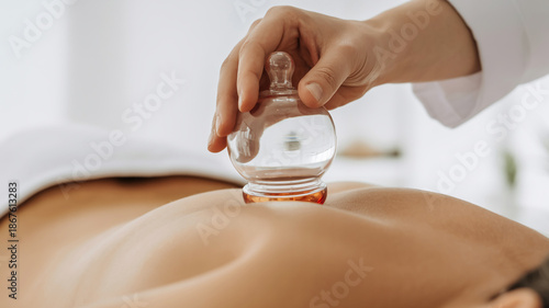 Close-up medical wellness photography of transparent glass cupping therapy on human back, natural skin tone, soft daylight, clinical spa setting, selective focus, professional healthcare treatment.