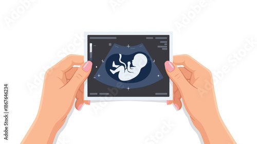 Hands holding prenatal ultrasound scan of a fetus, pregnancy concept