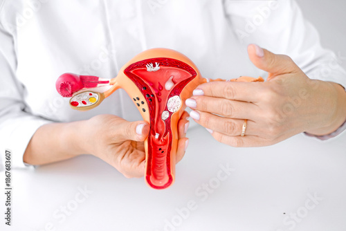 A gynecologist demonstrates neoplasms on a model of a female uterus to interns and students. Women's diseases. World Cancer Day