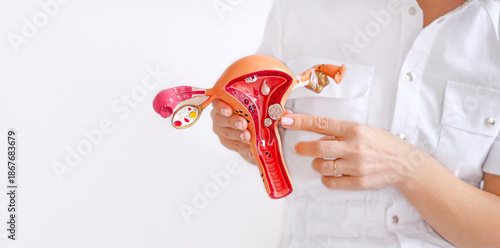 Anatomical model of the uterus with oncological tumors and formations for educational demonstration. Female Consultant Physician
