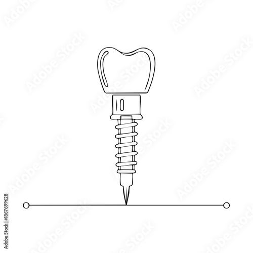 Dental Implant Line Art Illustration of Tooth with Screw for Medical Reference or Study