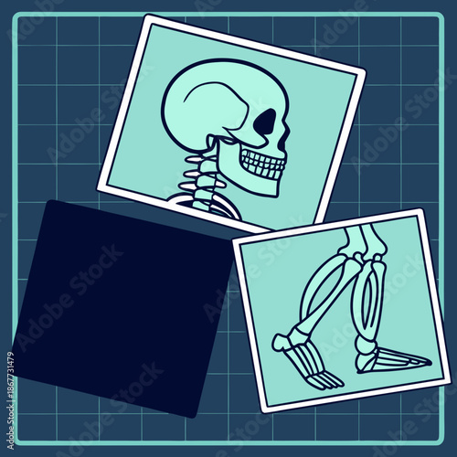 Skeletal anatomy x-ray with skull and leg bones. Medical radiology and healthcare illustration.