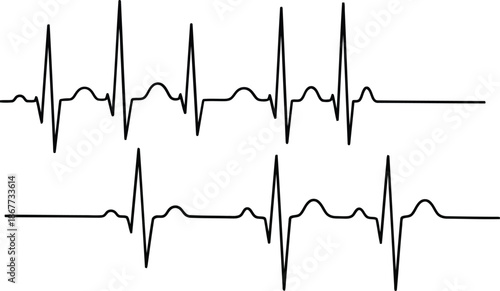 Electrocardiogram Vector Design