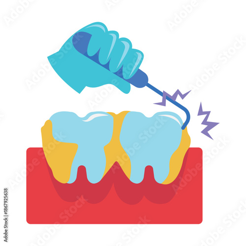 Dentist Gloved Hand Probing Tooth Cavity with Instrument.
