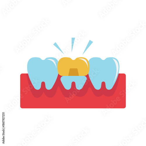 Shiny Gold Dental Crown on Bright Tooth.