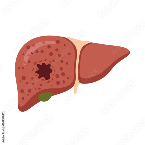 Human liver organ icon showing cirrhosis damage for hepatology design