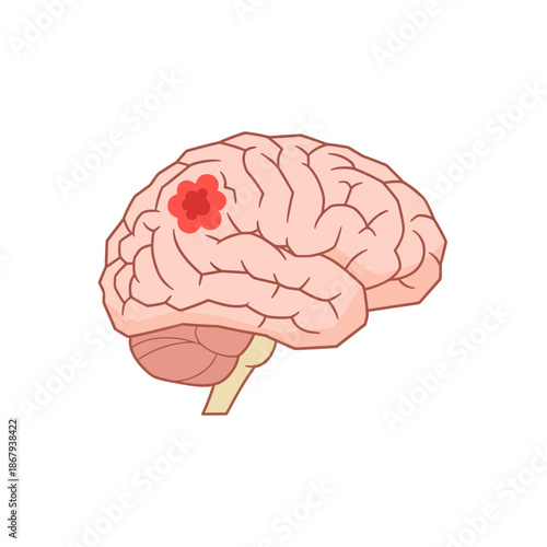 Human brain anatomy icon showing tumor area for neurology education