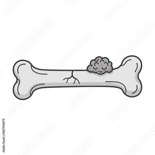 Bone Cancer Cartoon Vector Illustration, Osteosarcoma Tumor on Fractured Bone, Orthopedic Disease and Osteoporosis Concept
