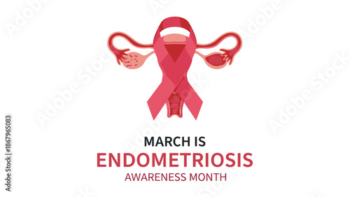An awareness poster for Endometriosis Awareness Month in March, featuring the female reproductive system with a supportive yellow ribbon.