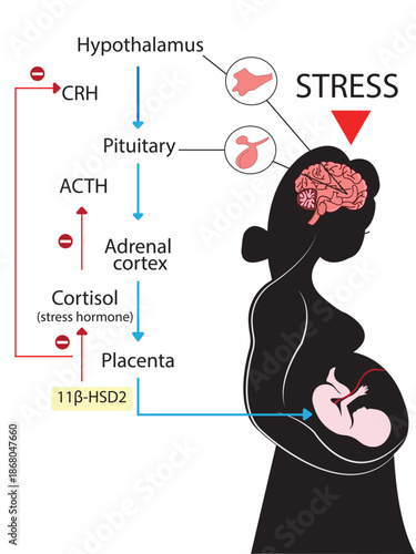 Infographic on the vertical line of effect of a mother's stress during pregnancy on the baby.
