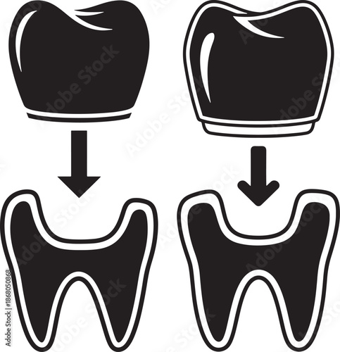 Dental Crown or Tooth Implant Procedure Silhouette Icon for Dentistry Oral Health and Medical Care