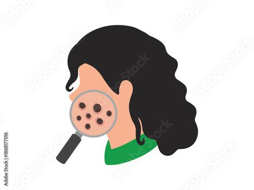 Acne Blackhead in Face Skin Illustration
