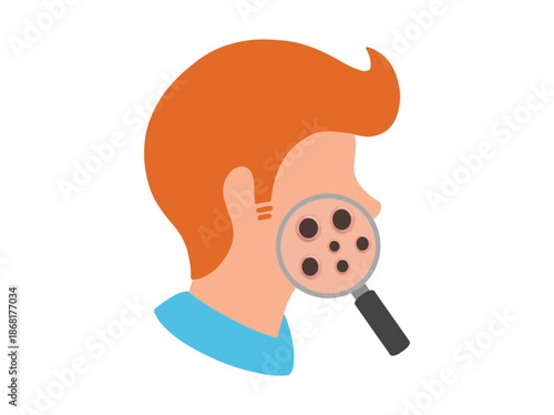 Hand Drawn Acne Blackhead Clip Art
