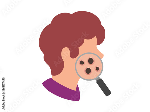 Acne Blackhead in Face Skin Illustration
