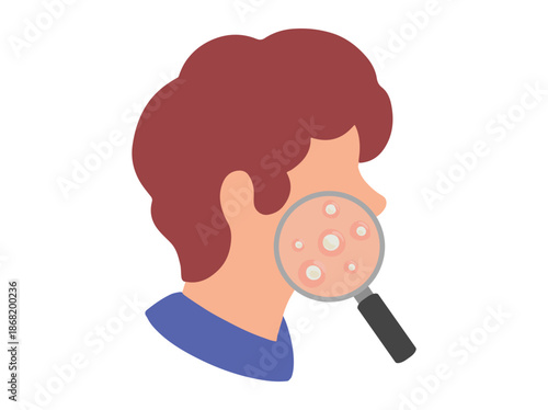 Hand Drawn Acne Whitehead in Face Skin Clip Art
