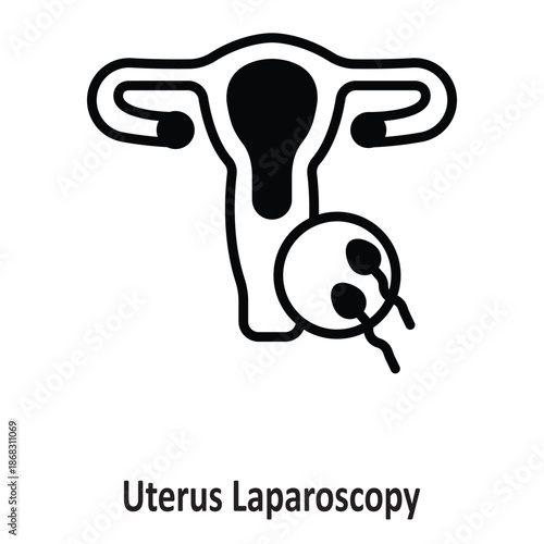 Uterus Laparoscopy Vector Icon which can easily modify or edit
