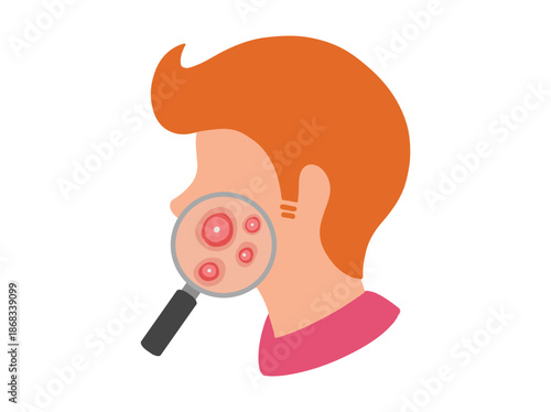 Acne Cystic in Face Skin Clip Art
