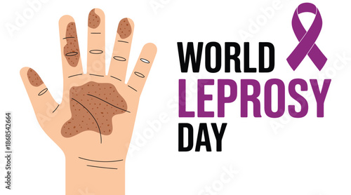 world leprosy day awareness illustration with human hand showing disease symptoms and purple ribbon promoting health, care and global awareness