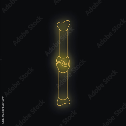 Glowing neon broken bone fracture medical concept illustration on black background