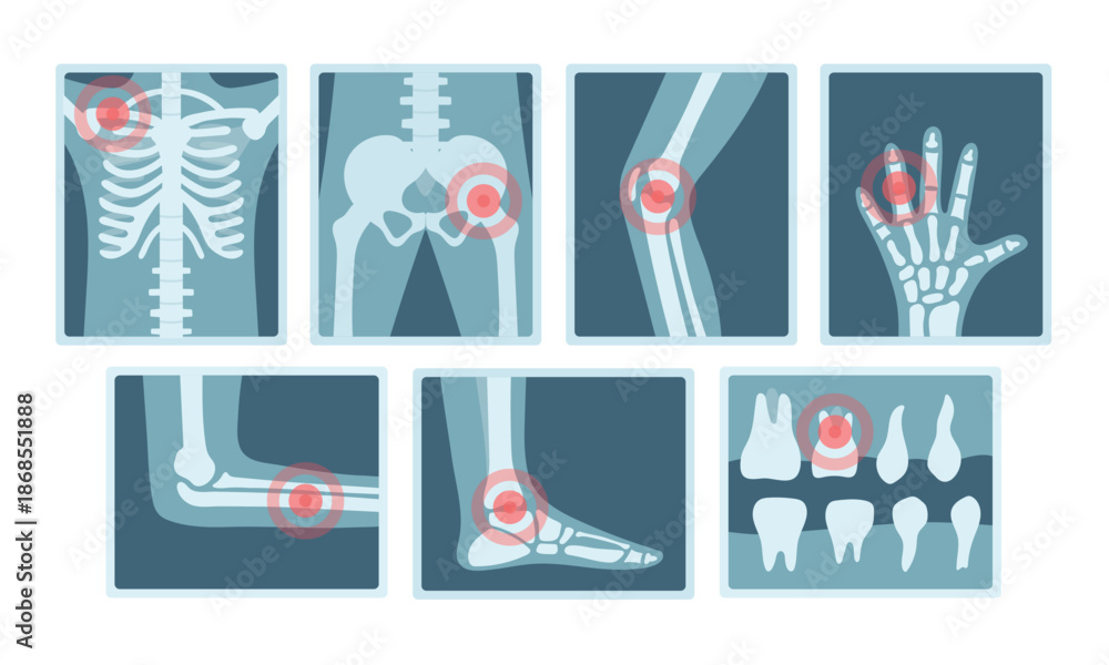 Αυτοκόλλητο A set of X-ray images of various parts of the human body with a red dot on a white background