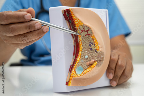 doctor holding female breast human anatomy model.