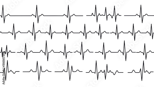 Heartbeat ECG Rhythms: Medical Monitoring Signals