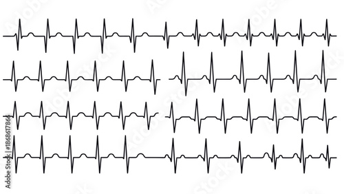 Heartbeat ECG Pattern: Medical Monitoring Concept