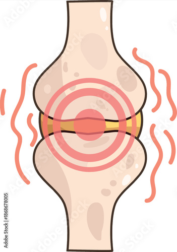 Illustration of human knee joint with pain indication