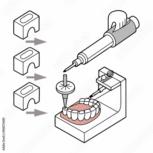 Dental Ceramic Manufacturing Process for High Precision Crowns and Prosthetics in a Medical Laboratory