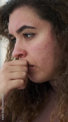 Vertical video of a thoughtful and sad young woman with problem skin. She is worried and covers her face with her hands in despair.