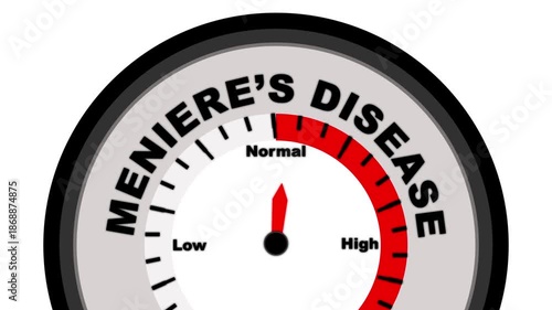 Meniere’s Disease text or word shown with a barometer or tachometer-style gauge, representing varying levels of inner ear disorder severity and impact on balance and hearing