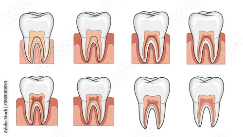 Dental Health Illustration A Detailed Look at Tooth Anatomy and Structure