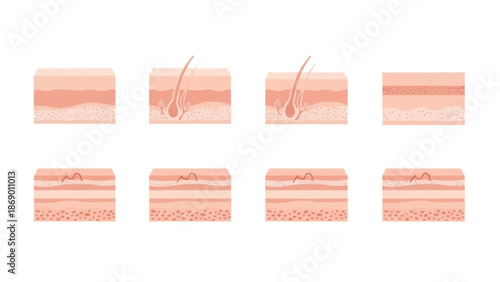 Illustration of Skin Layers and Structures A Detailed Visual Guide for Education and Health