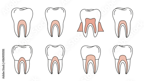 Dental Illustrations A Visual Guide to Tooth Anatomy and Procedures