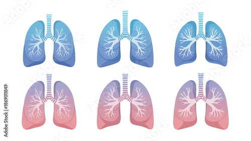Healthy and Diseased Lungs A Visual Comparison of Respiratory Health
