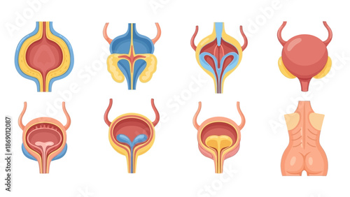 Medical illustration of various stages of the human bladder and its structure